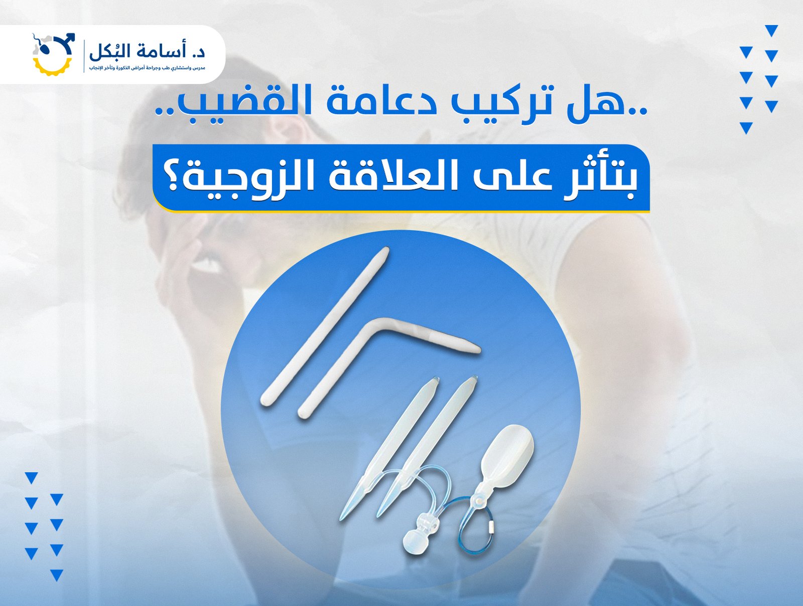 هل تركيب دعامة القضيب بتاثر على العلاقة الزوجية ؟