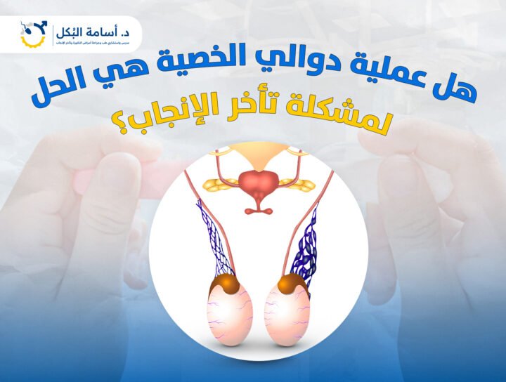 هل عملية دوالي الخصية هي الحل لمشكلة تاخر الانجاب ؟