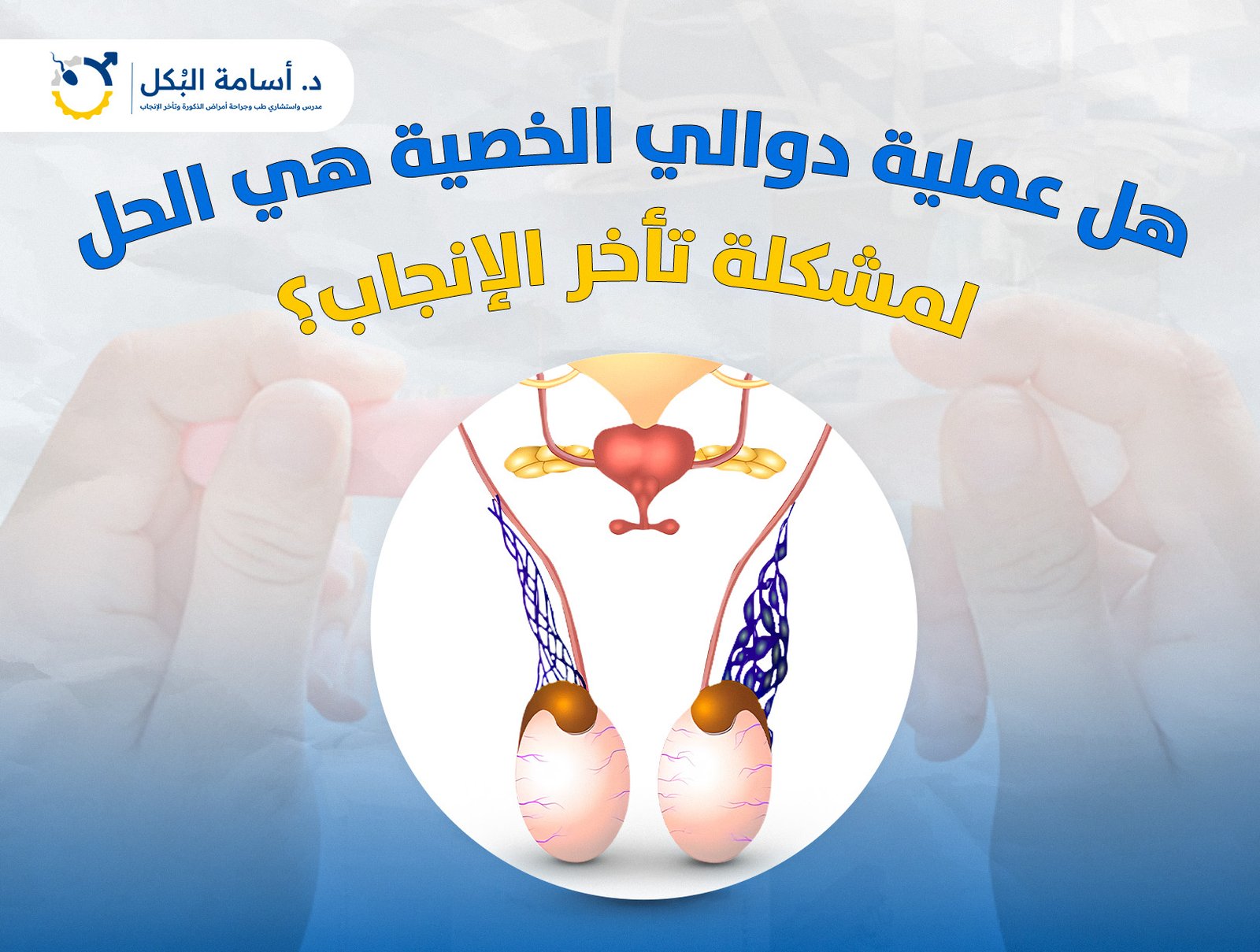 هل عملية دوالي الخصية هي الحل لمشكلة تاخر الانجاب ؟