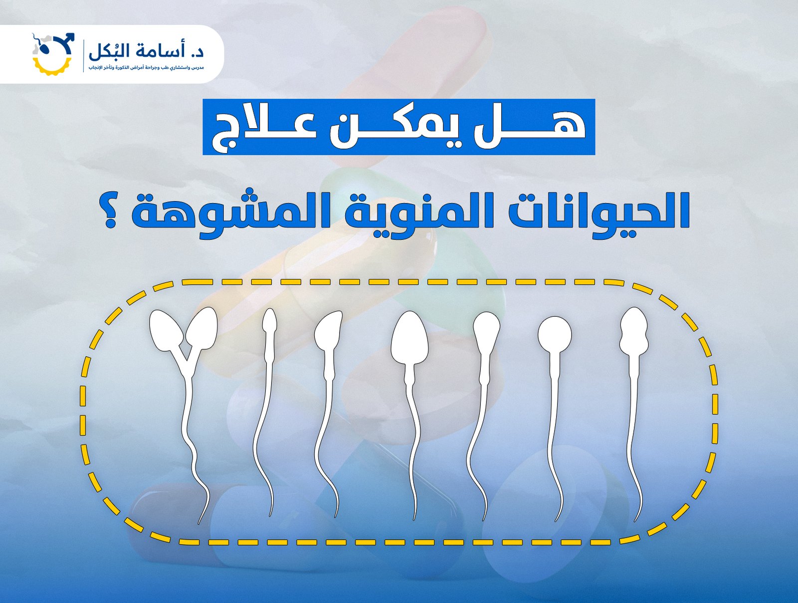 هل يمكن علاج الحيوانات المنوية المشوهة ؟