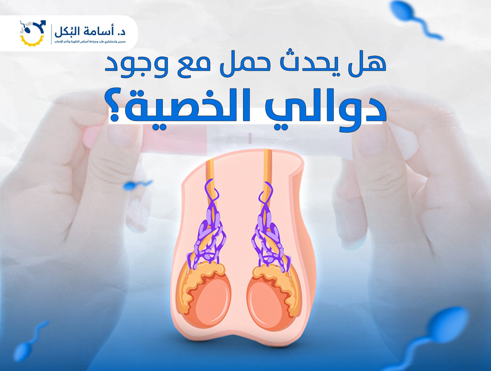 هل يحدث حمل مع وجود دوالي الخصية؟