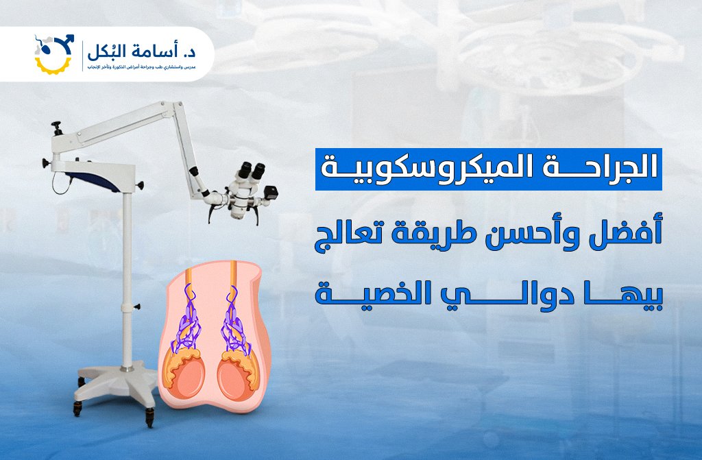 الجراحة الميكروسكوبية افضل واحسن طريقة تعالج بيها دوالي الخصية