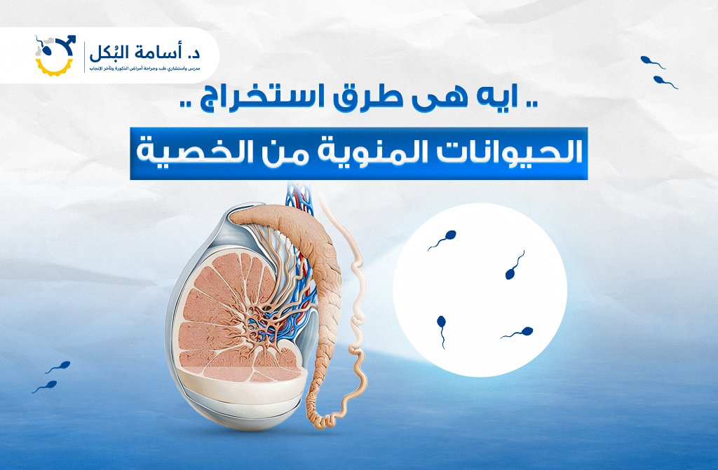 ايه هى طرق استخراج الحيوانات المنوية من الخصية