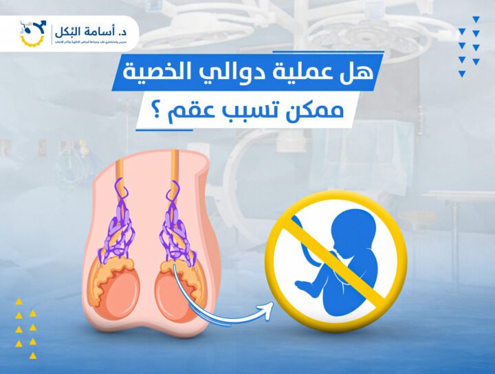هل عملية دوالي الخصية ممكن تسبب عقم ؟