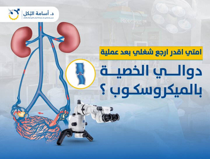 امتي اقدر ارجع شغلي بعد عملية دوالي الخصية بالميكروسكوب ؟