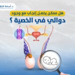 هل ممكن يحصل انجاب مع وجود دوالى فى الخصيه