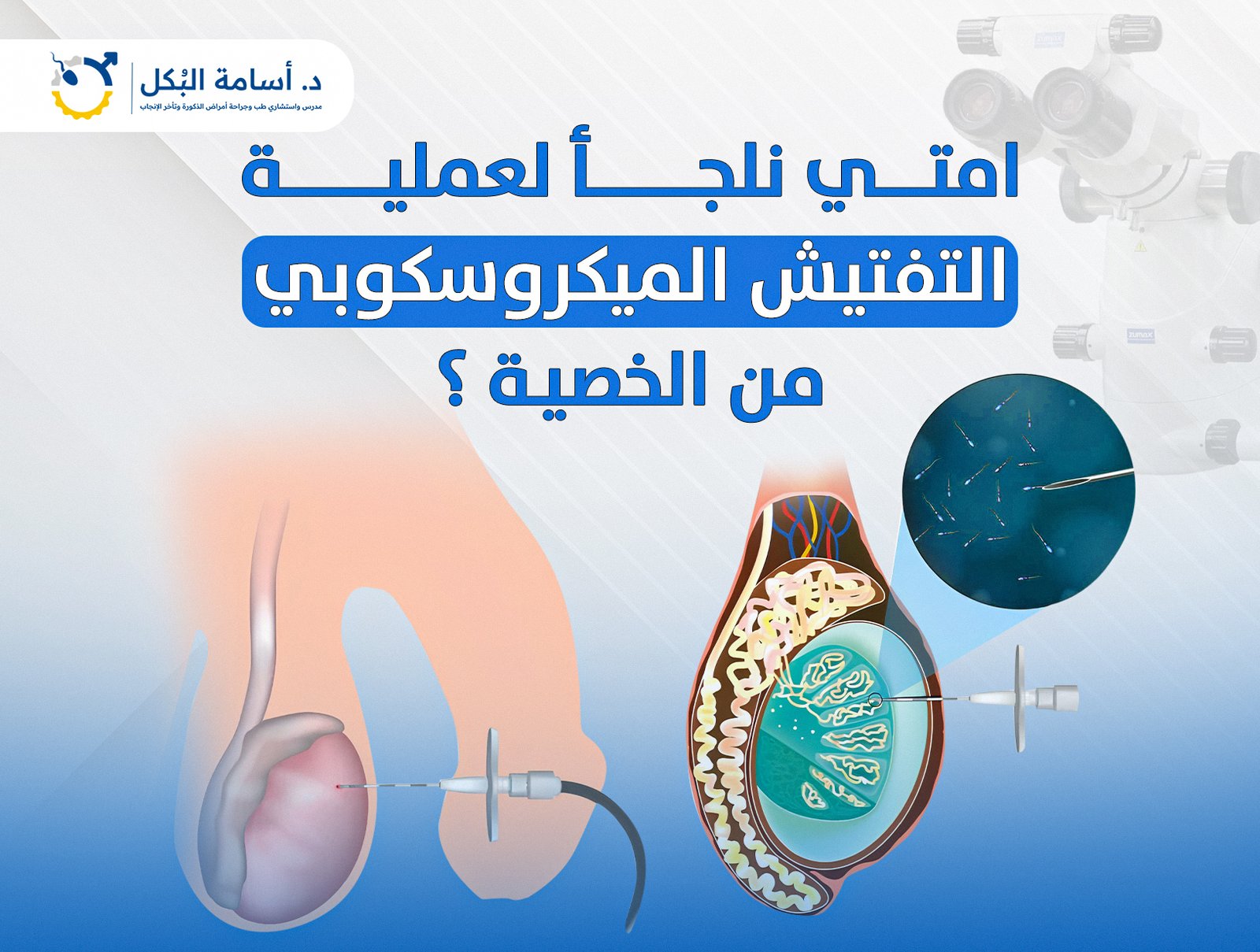 امتي نلجأ لعملية التفتيش الميكروسكوبي من الخصية ؟