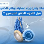 لماذا يتم إجراء عملية دوالي الخصية قبل اللجوء للحقن المجهري ؟