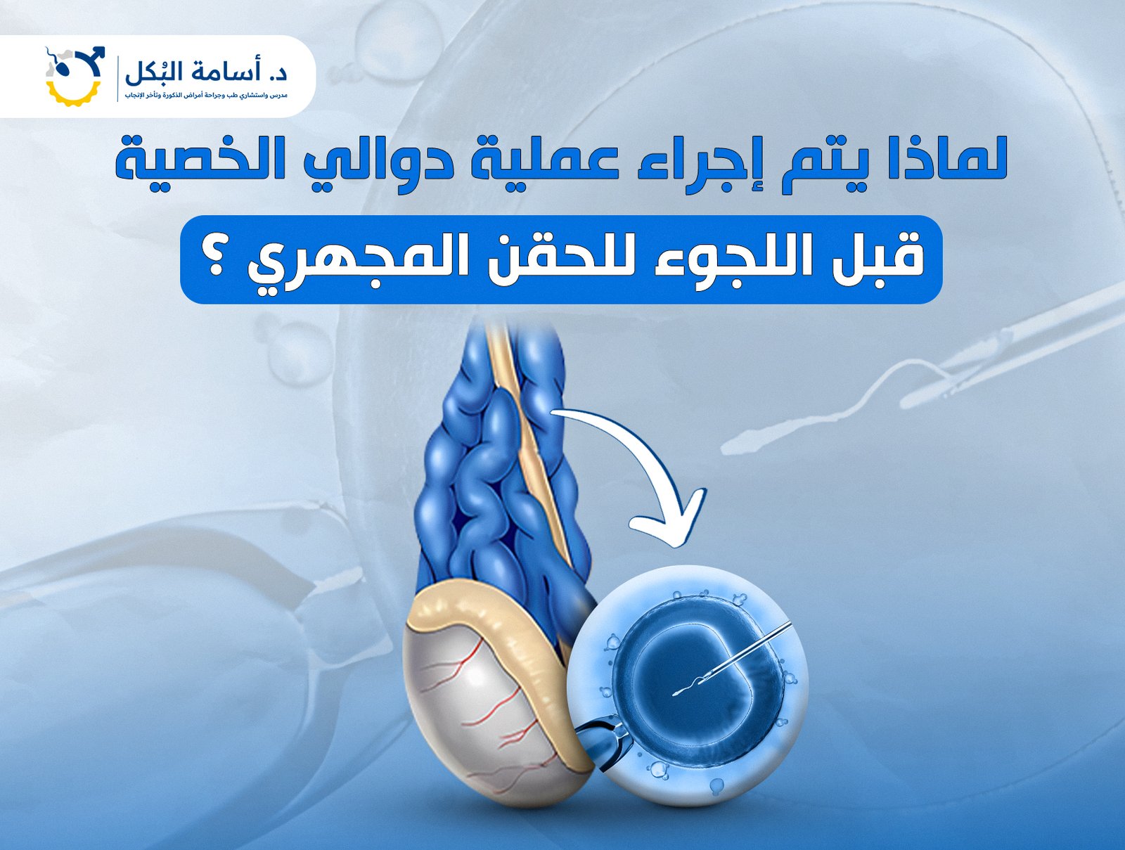 لماذا يتم إجراء عملية دوالي الخصية قبل اللجوء للحقن المجهري ؟