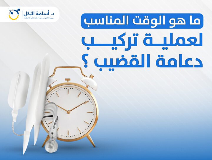 ما هو الوقت المناسب لعملية تركيب دعامة القضيب ؟