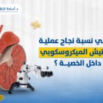 ما هي نسبة نجاح عملية التفتيش الميكروسكوبي داخل الخصية ؟
