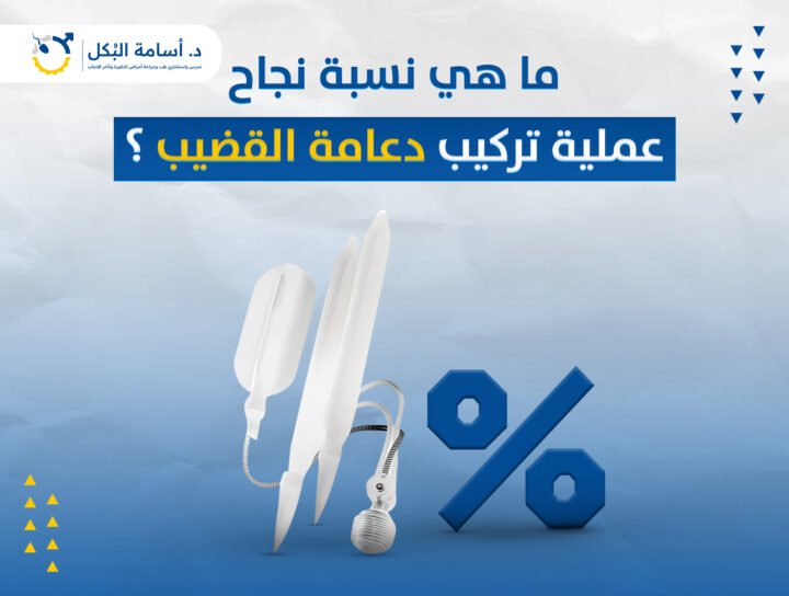 ما هي نسبة نجاح عملية تركيب دعامة القضيب ؟