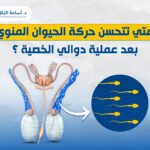 متي تتحسن حركة الحيوان المنوي بعد عملية دوالي الخصية ؟