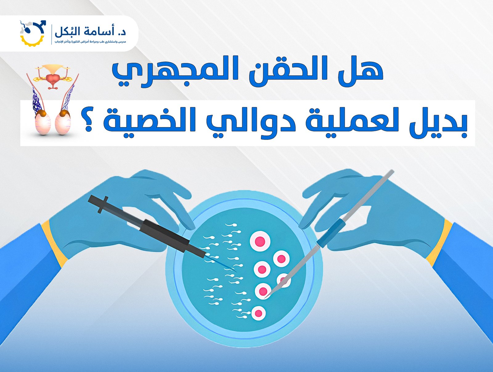 هل الحقن المجهري بديل لعملية دوالي الخصية ؟