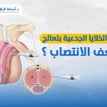 هل الخلايا الجذعية بتعالج ضعف الانتصاب ؟