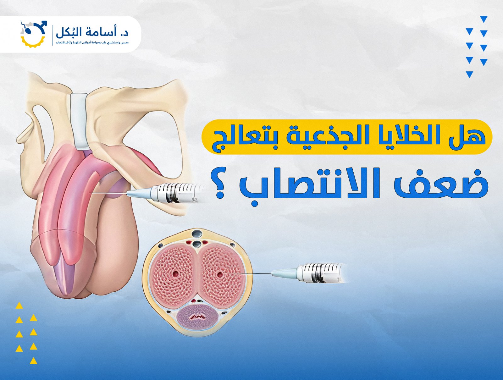 هل الخلايا الجذعية بتعالج ضعف الانتصاب ؟
