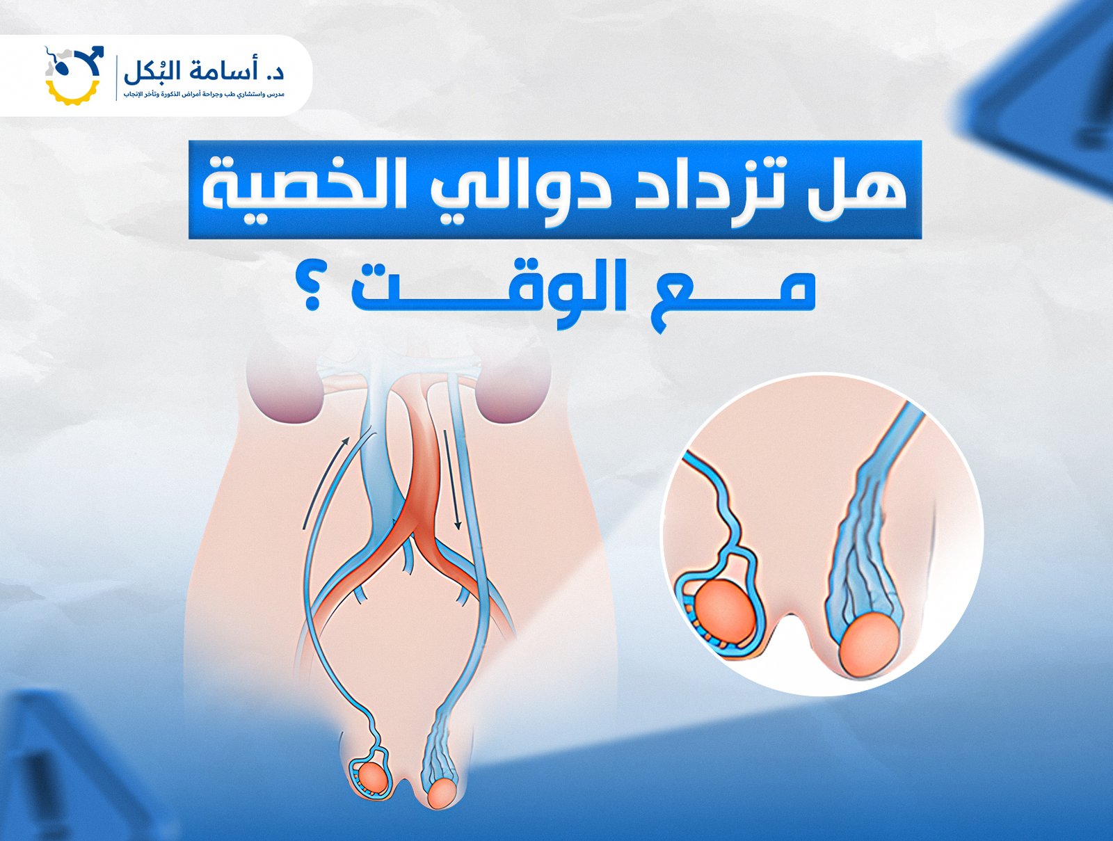 هل تزداد دوالي الخصية مع الوقت ؟