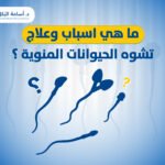 ما هي اسباب وعلاج تشوه الحيوانات المنوية ؟