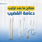 نصائح ما بعد تركيب دعامة القضيب