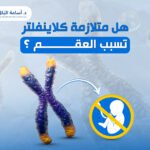 هل متلازمة كلاينفلتر تسبب العقم ؟
