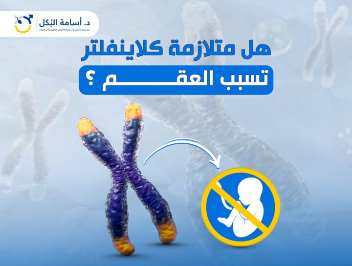هل متلازمة كلاينفلتر تسبب العقم ؟
