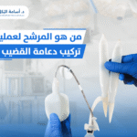 من هو المرشح لعملية تركيب دعامة القضيب ؟